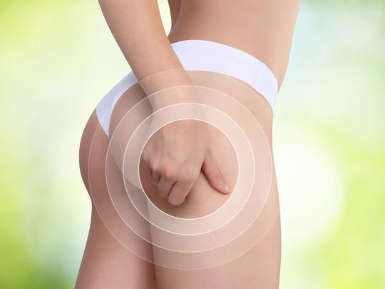 se débarrasser de la cellulite